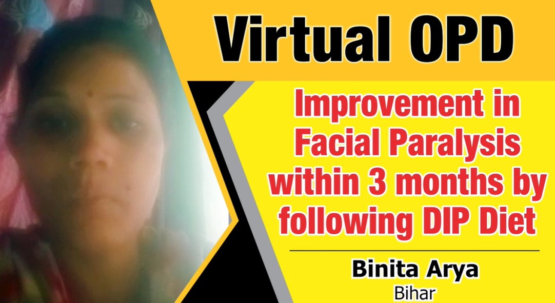 Improvement in Facial Paralysis within 3 months by following DIP Diet