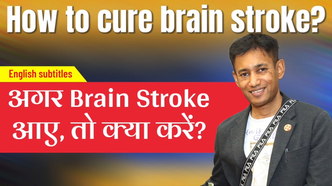 How to Cure Brain Stoke